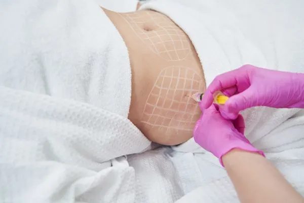 image of fat dissolving injections on love handles to help combat weight gain Mansfield