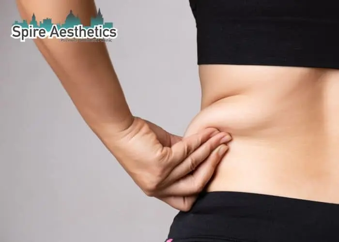Image of woman pinching fat on their hips Mansfield. Fat Freezing treatment