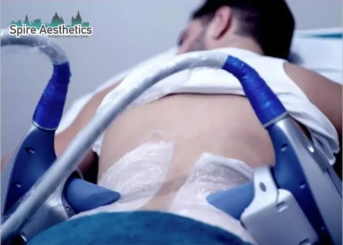 Man having fat freezing treatment done on love handles before a competitions Mansfield to create a sculpted look.